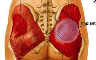MEDICINA: BRASIL É O CAMPEÃO DAS PRÓTESES