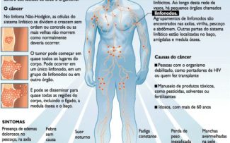 CIÊNCIA: CURA DE LINFOMA SEM QUIMIO